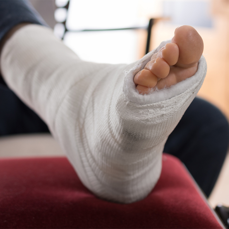 10 Broken Ankle Tips For Faster Recovery