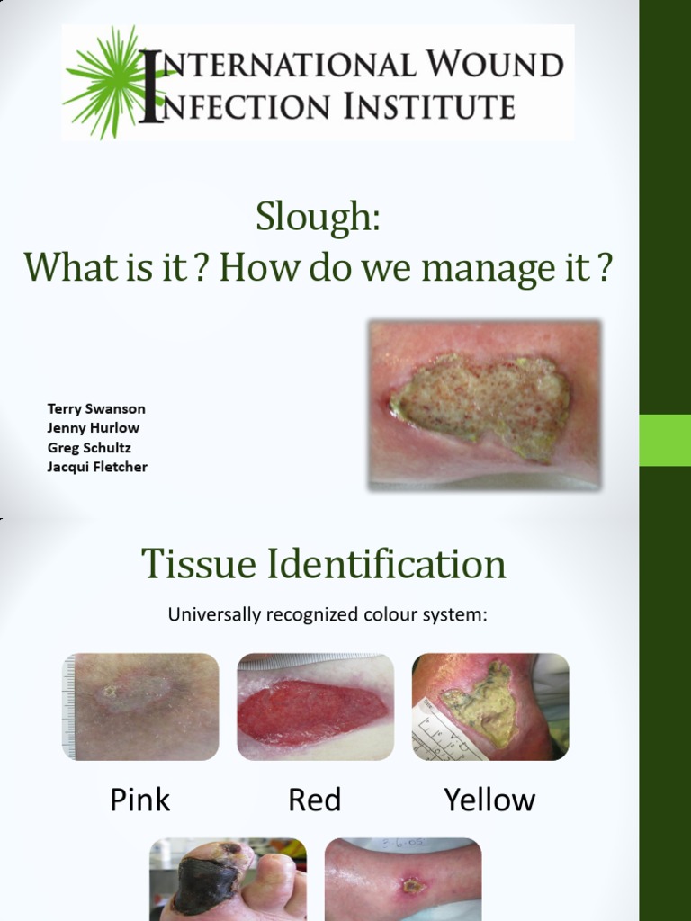 10 Slough On Wound Pictures For Easy Identification