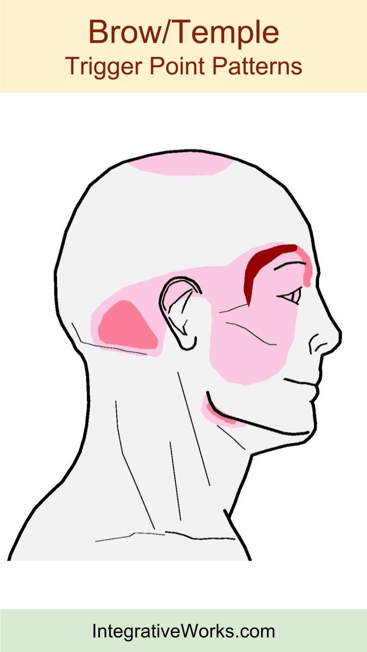 12 Headache Remedies For Right Temple Relief