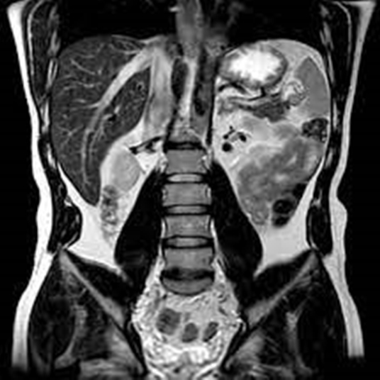 12 Mri Abdomen Pelvis Tips For Accurate Diagnosis