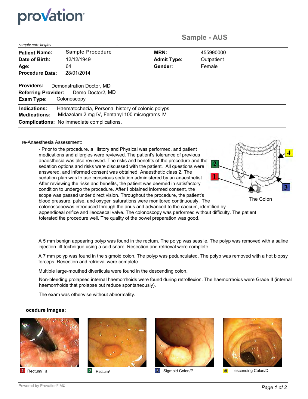 Abnormal Colonoscopy