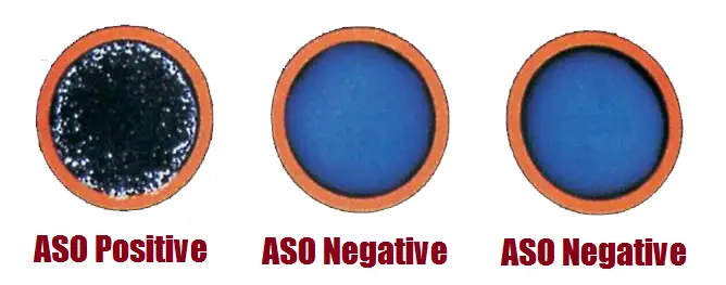 Aso Anti Streptococcal O Test Introduction Principle Procedure Aso Anti Streptococcal O Test Introduction Principle Procedure