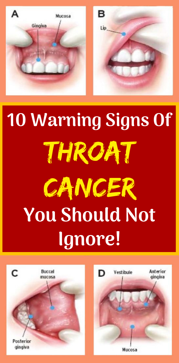 Back Of Throat Photos: Identify Symptoms Easily