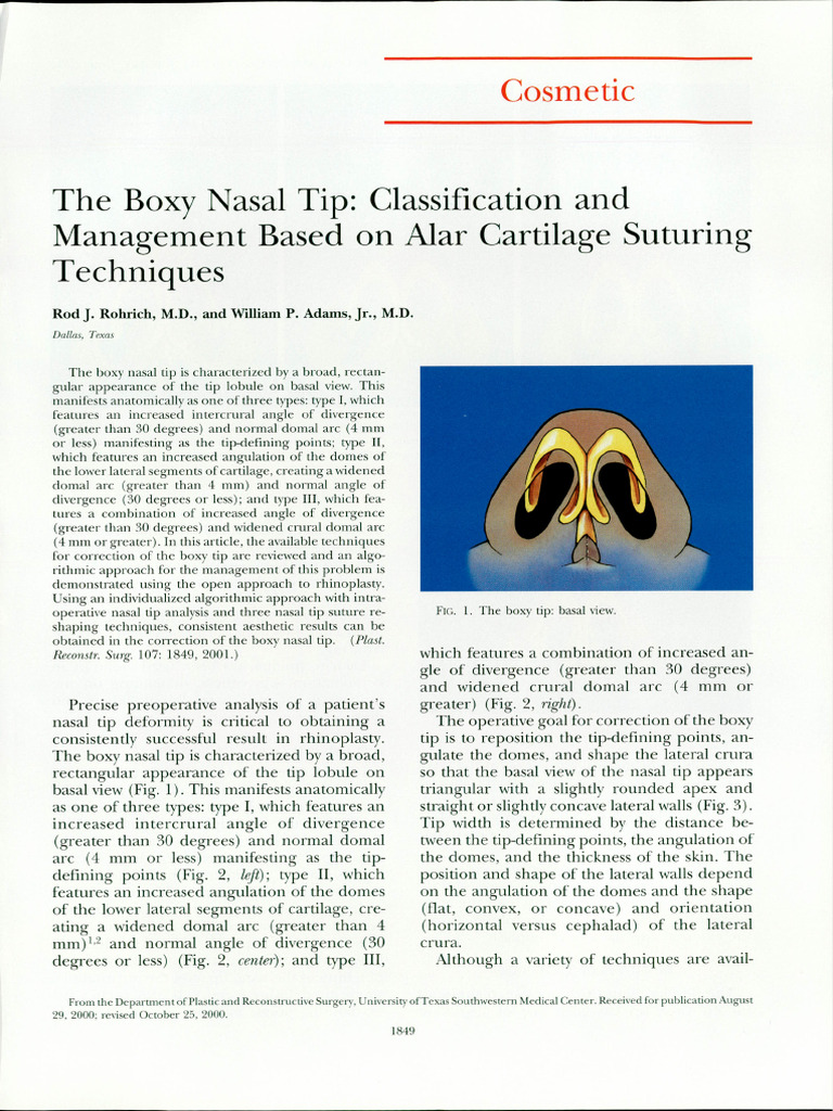 Boxy Nasal Tip: Fix With Simple Exercises