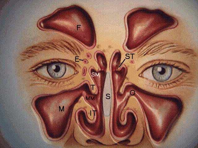 Cat Scan For Sinuses: Diagnose Infections Accurately