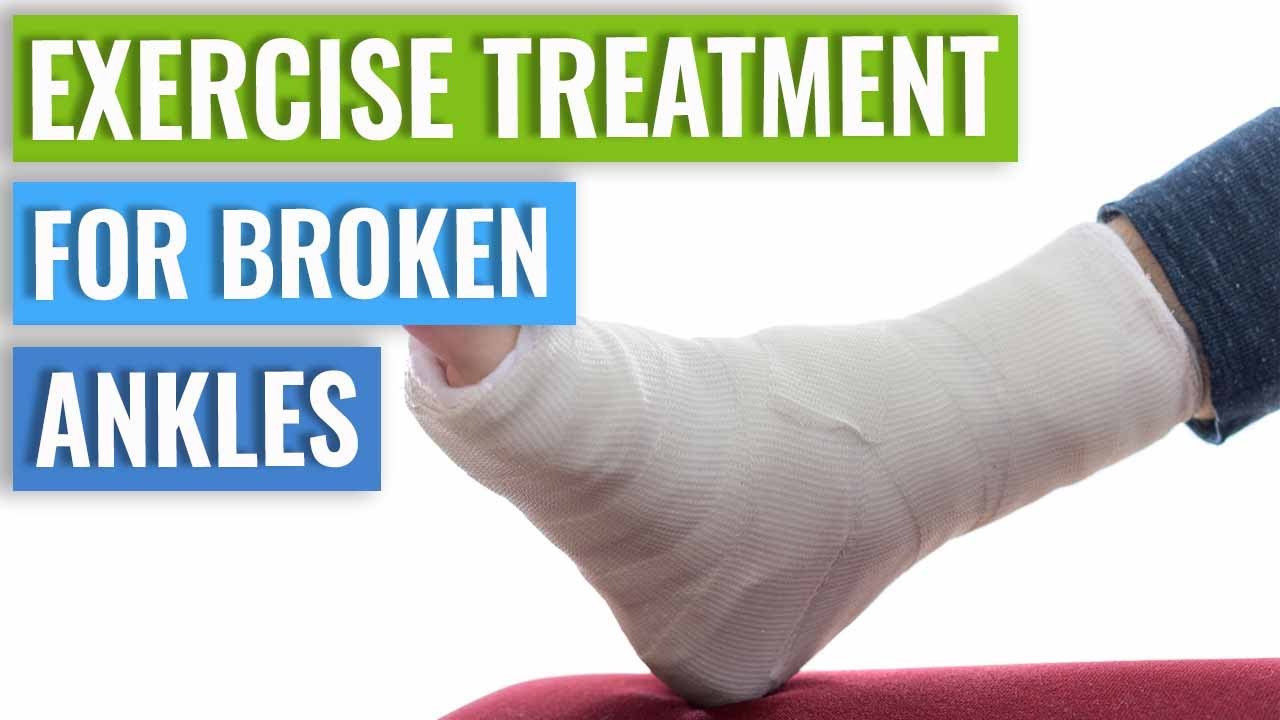 Clavicle Fracture Exercises: Reduce Pain And Recovery Time