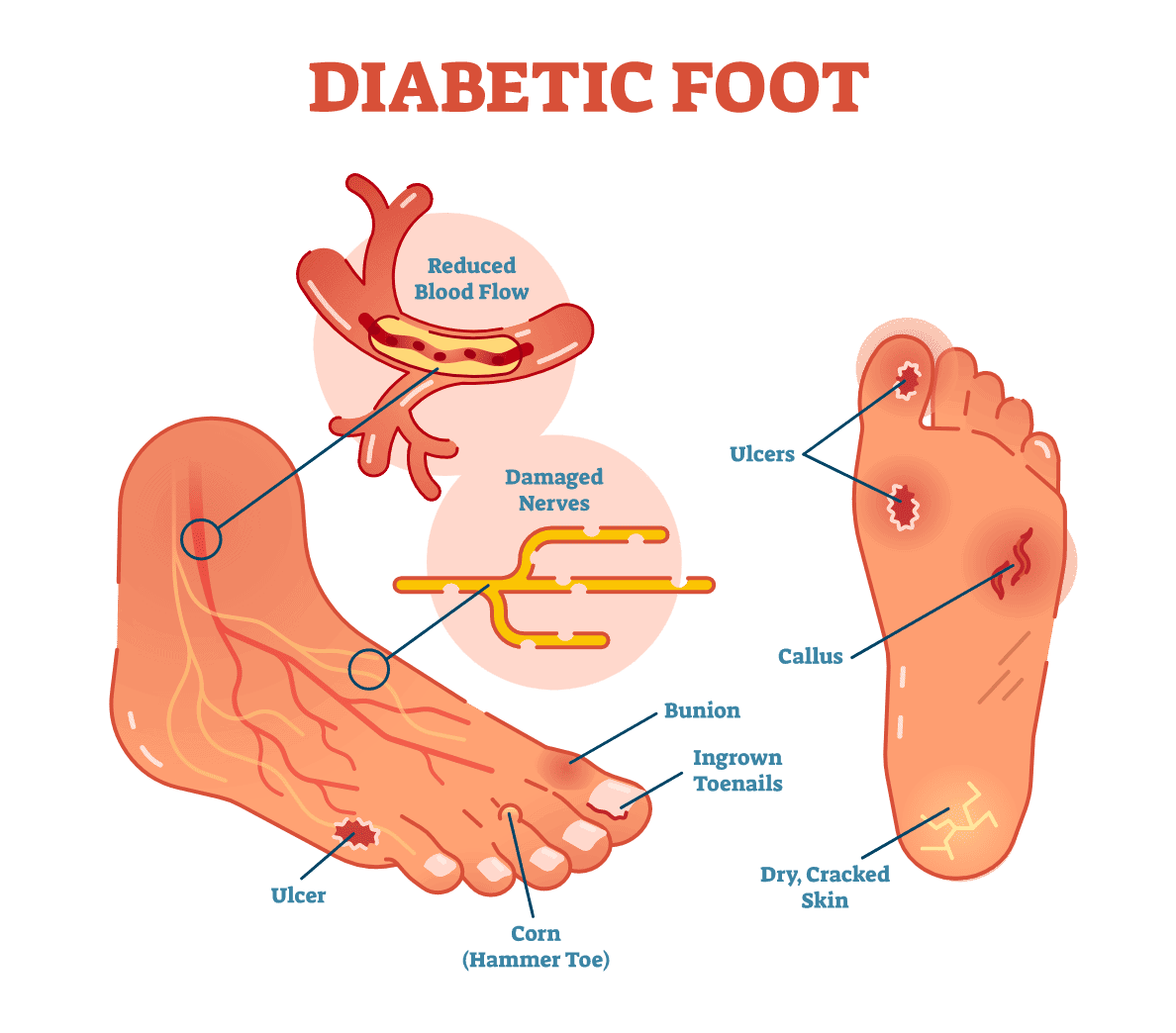 Connie Carter Foot Care Tips