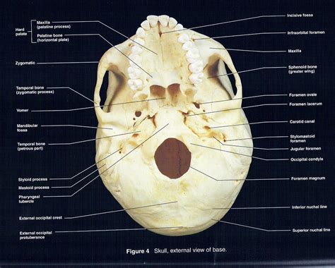 Inferior Skull Labeled