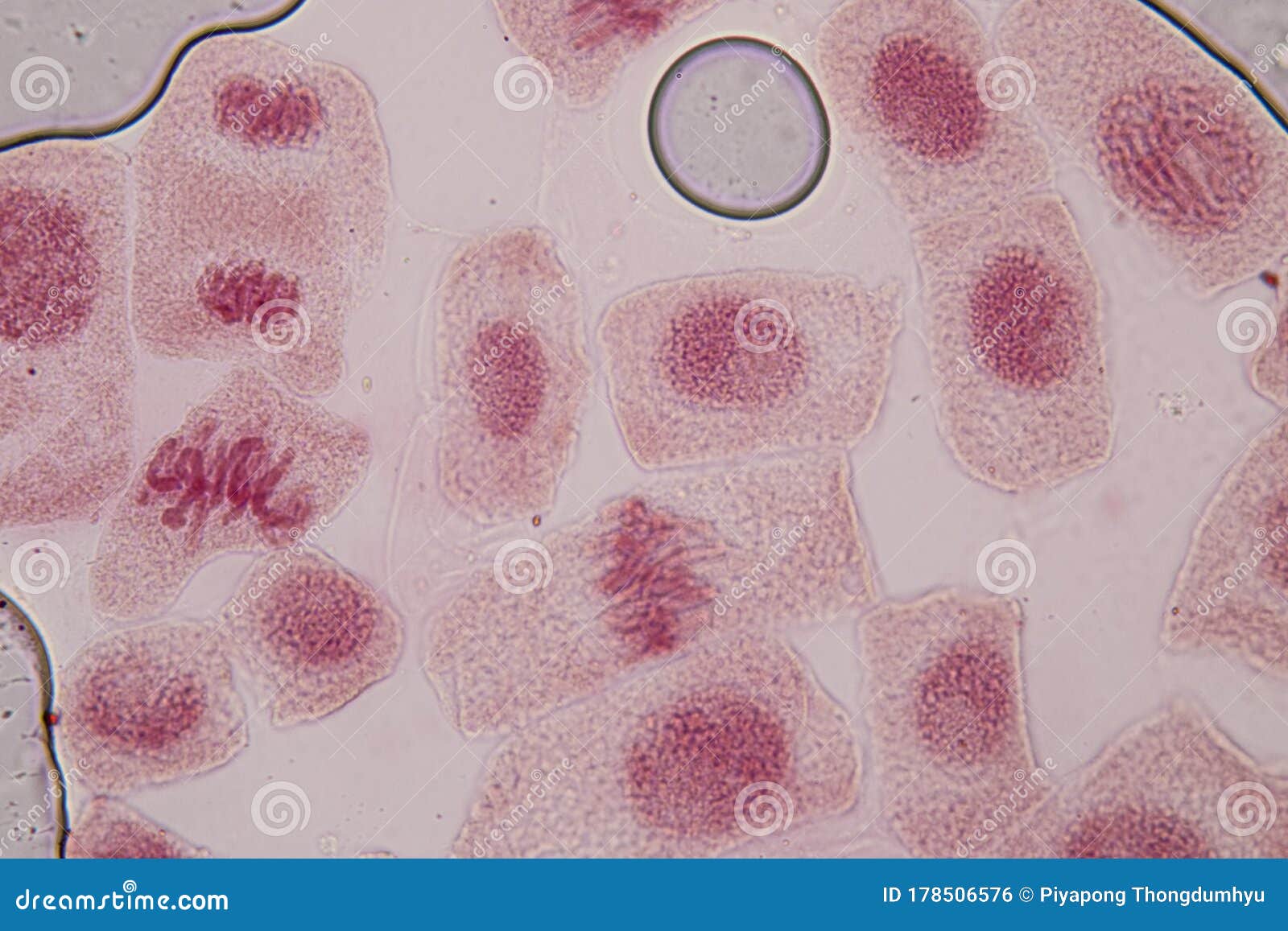 Interphase Onion Root Tip