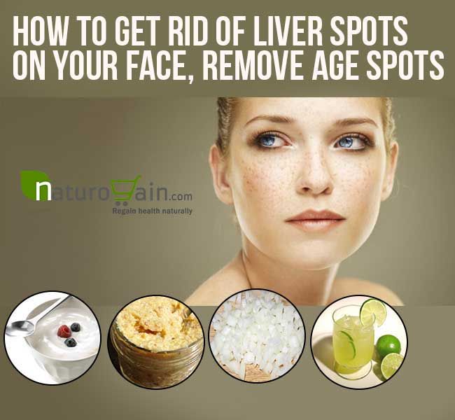 Liver Spots On Face Images