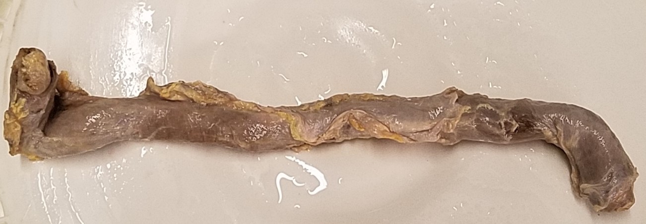 Pig Esophagus[ Function