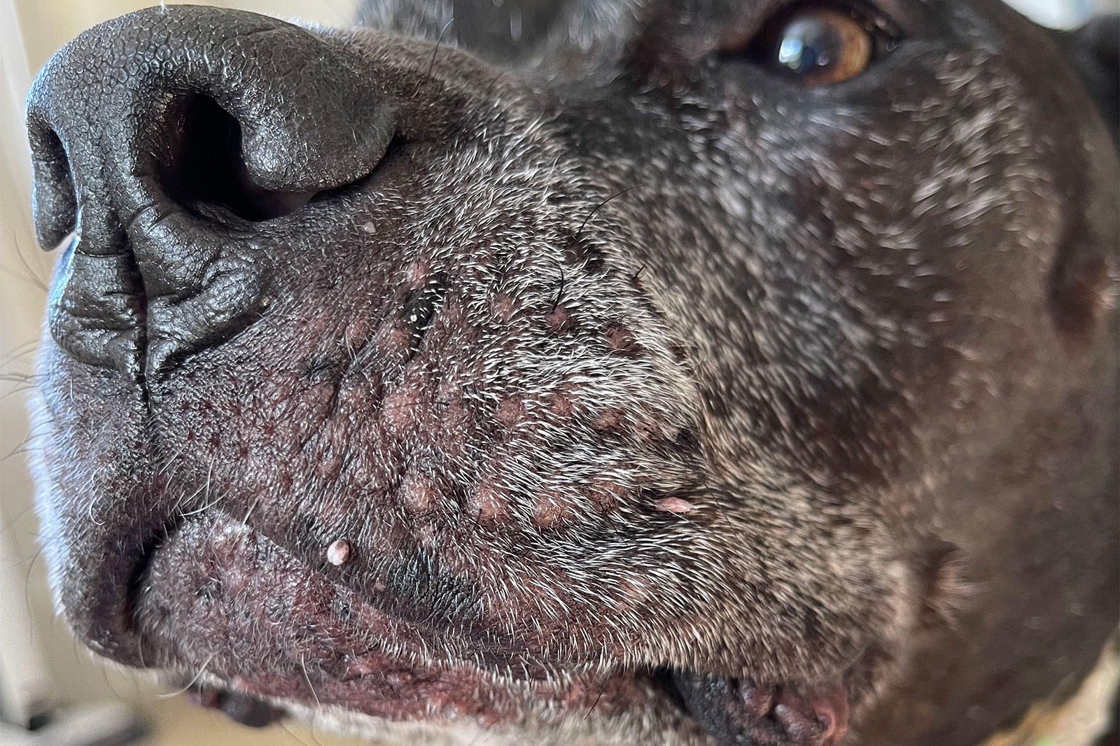 Skin Tags On Ears