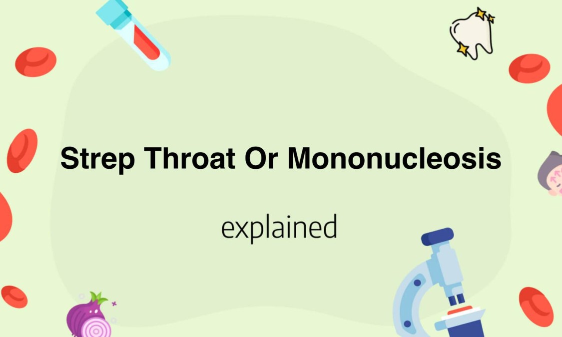 Strep Throat Mononucleosis