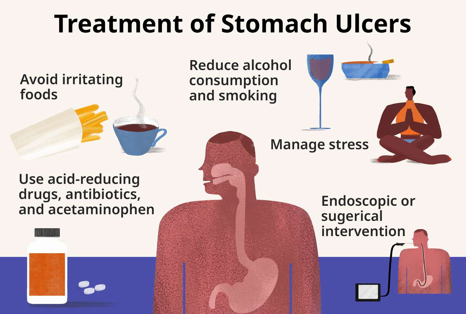 Ulcer Image