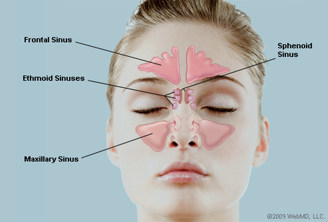 What Do Ct Sinus Results Mean? Get Answers
