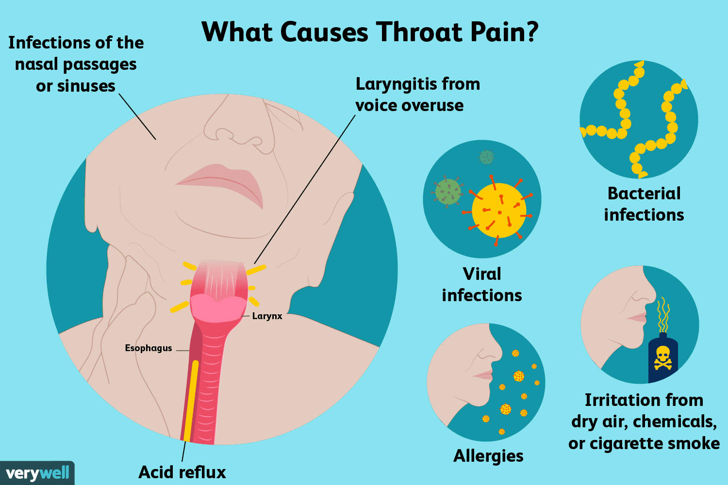 When Does Throat Pain Stop After Running? Expert Advice